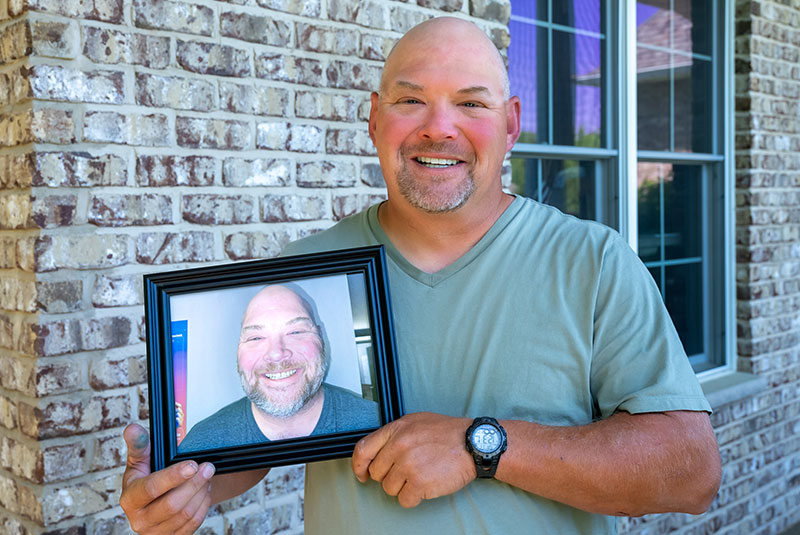 Stock treatment imagery — patient photograph to follow