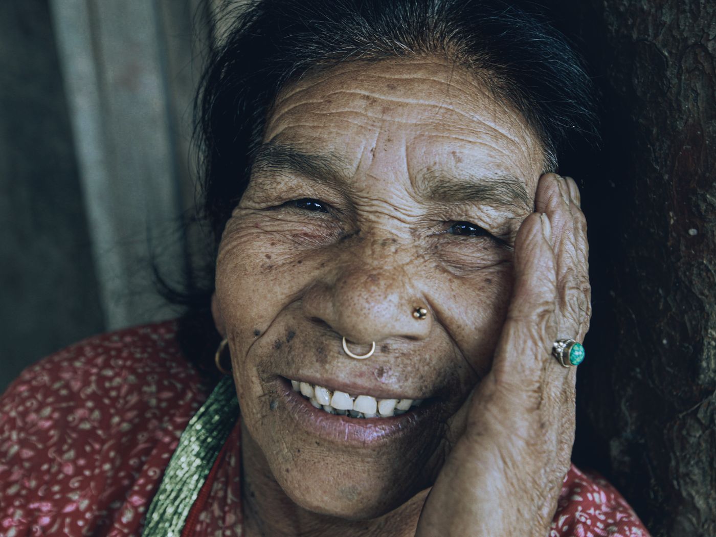 Stock treatment imagery — patient photograph to follow