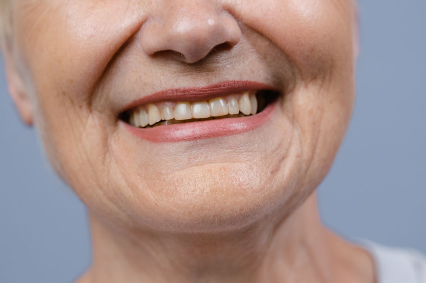 Stock treatment imagery — patient photograph to follow